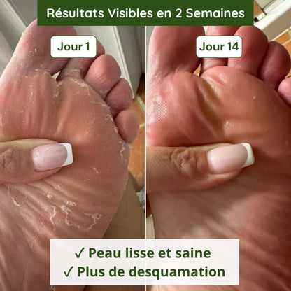 Savon Anti-Mycoses Verdalyae