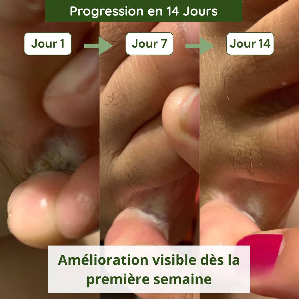 Savon Anti-Mycoses Verdalyae